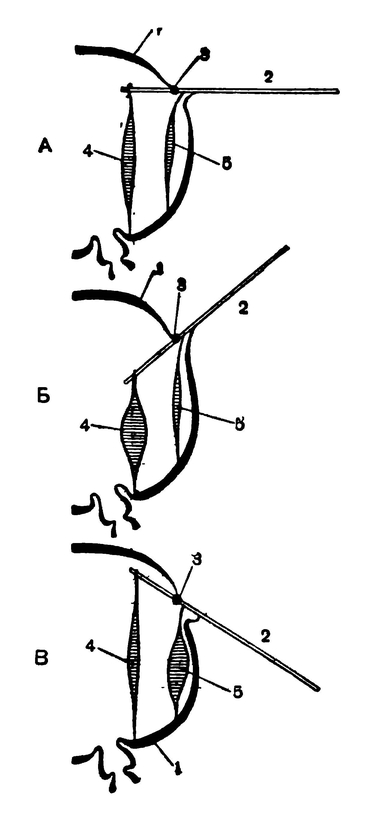 Схема, поясняющая механизм движения крыльев насекомого