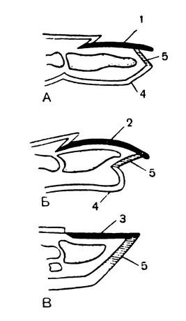 Продольные разрезы через концы пальцев млекопитающих