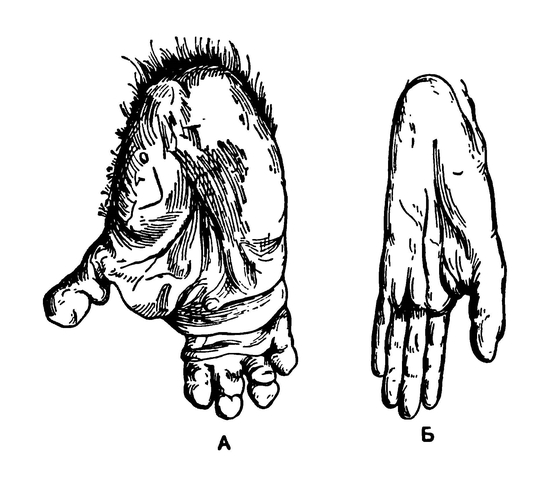 Стопа гориллы (А) и шимпанзе (Б)